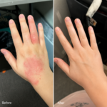 Crème pour l'Inflammation de la Peau & Peau Saine – Apaise les démangeaisons, les rougeurs et les desquamations 50ml – Image 9