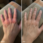 Crème pour l'Inflammation de la Peau & Peau Saine – Apaise les démangeaisons, les rougeurs et les desquamations 50ml – Image 8