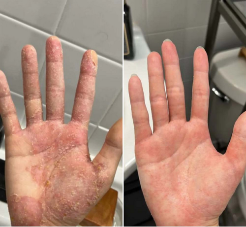 Crème pour l'Inflammation de la Peau & Peau Saine – Apaise les démangeaisons, les rougeurs et les desquamations 50ml photo review